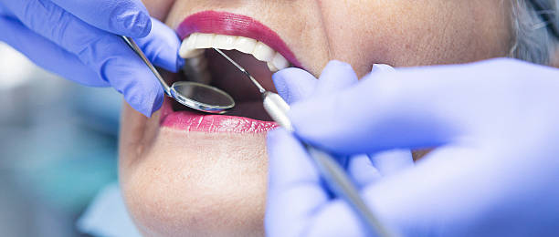 Best Emergency Dental Care for Broken or Chipped Teeth in Keystone Heights, FL